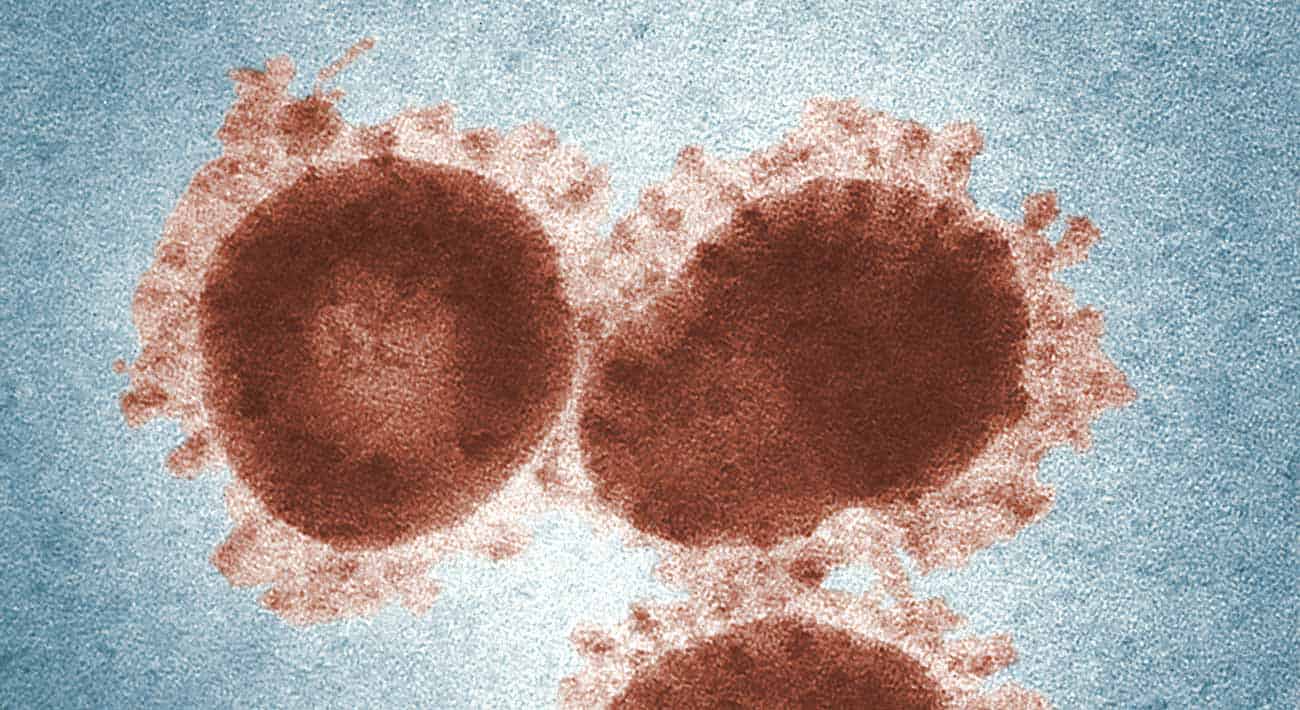 Argentina Caspr Coronavirus