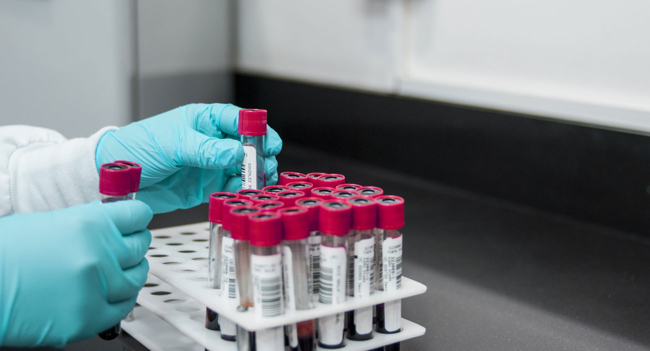 Hi Technologies Está Produciendo Pruebas Para El Coronavirus A Toda Velocidad